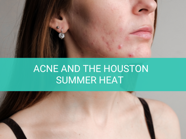 Acne and the Houston Summer Heat