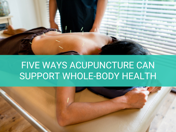 Five Ways Acupuncture Can Support Whole-Body Health