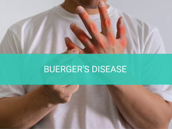 Buerger's Disease